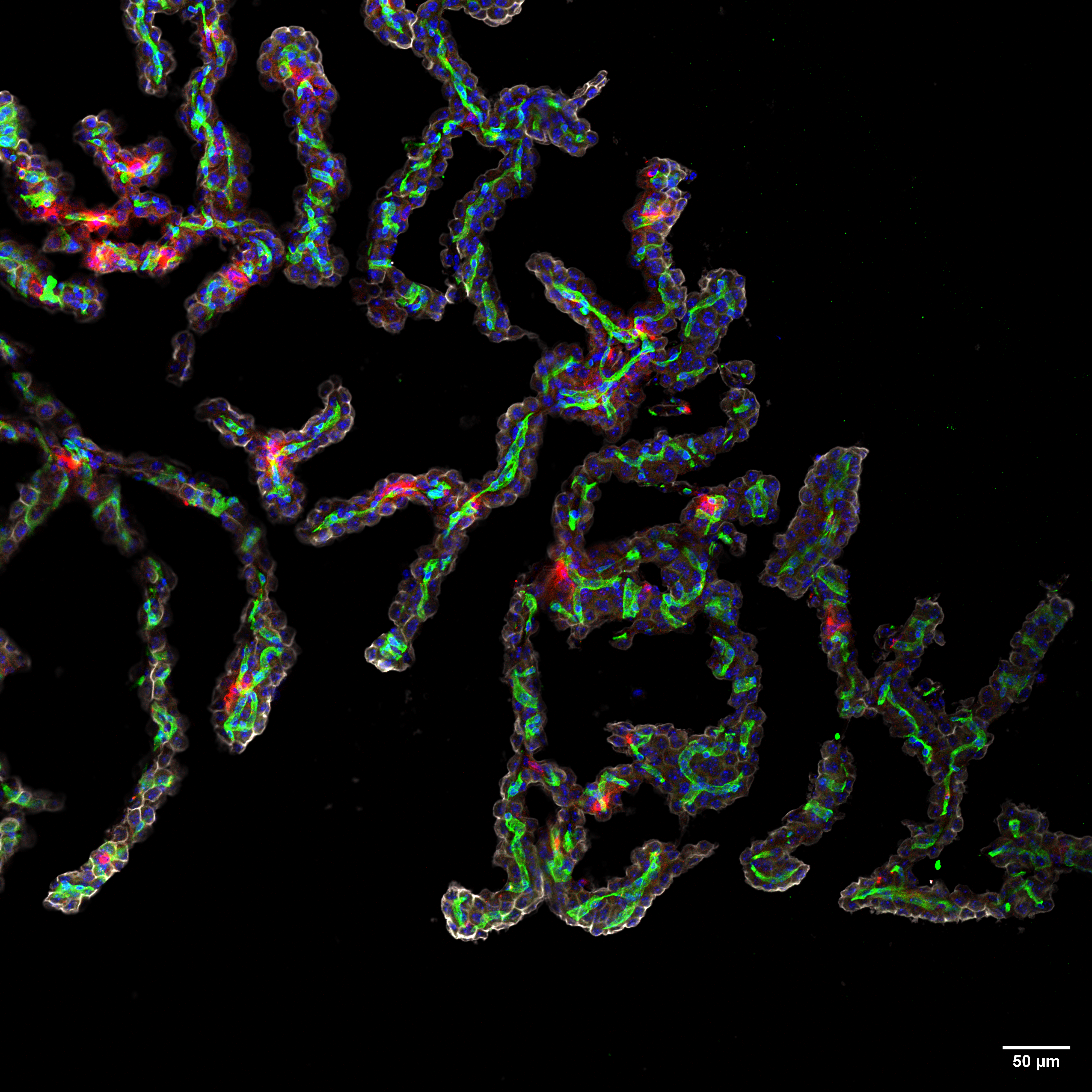 Drug Delivery to the Brain’s Barriers